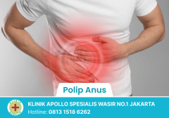 Polip Anus